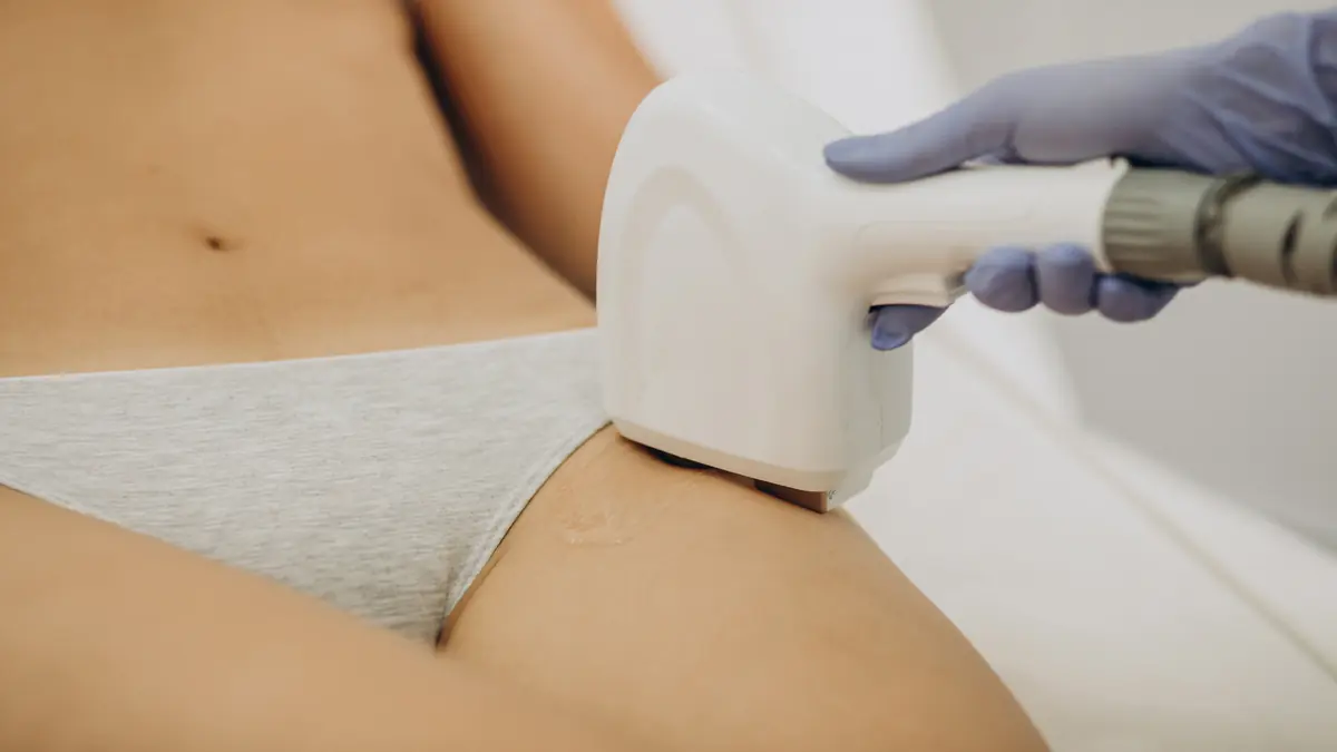 Tudo Sobre a Depilação Feminina na Região da Virilha